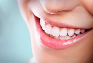 Extracción de 3er Molar Semi Incluido + Malla de Fibrina