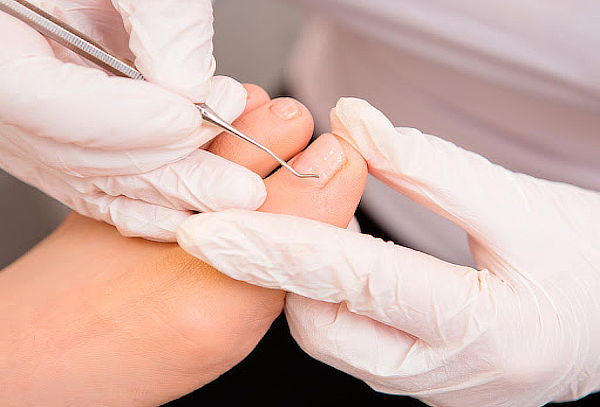 Podología Normal + Hidratación + Masaje Podal
