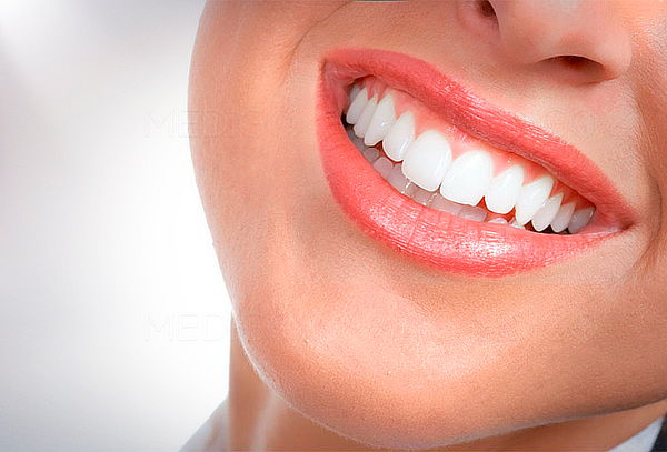 Portosalud: Limpieza Dental con Destartraje y Profilaxis
