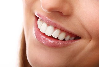 Diseño de Sonrisa: 6 Carillas Dentales Estéticas