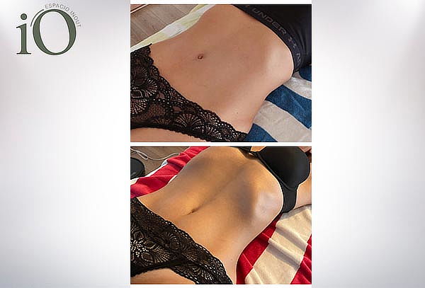 Masaje Detox, Desinflama y Equilibra tu Cuerpo en InOut