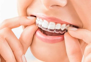 Placa Personalizada para Bruxismo en Dental Magallanes