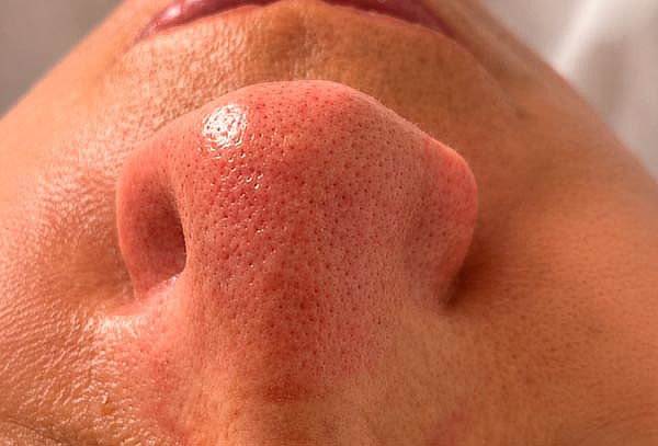 Limpieza Facial Profunda + Regalo de Cortesía