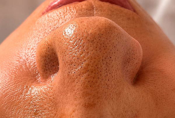 Limpieza Facial Profunda + Regalo de Cortesía