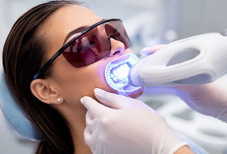 1 Sesion de blanqueamiento dental + Limpieza para 2 personas