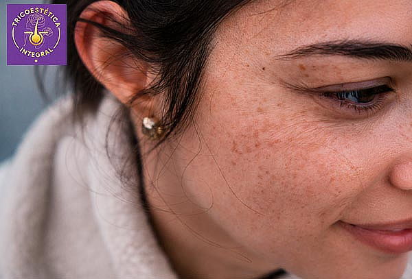 Peeling Renovador Facial + Exfoliación Profesional Cassmara 