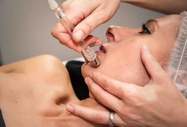Limpieza facial profunda con Fotototera Microdermoabrasión 