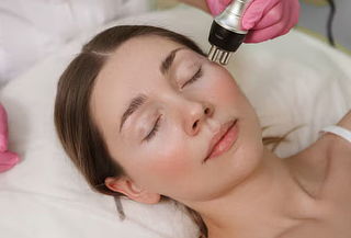 Dermaplaning + Limpieza facial profunda en Sunrise
