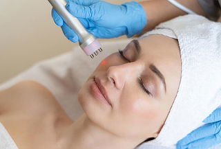 Radiofrecuencia 30 minutos facial cuello y escote o Papada 
