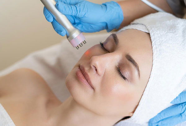 Radiofrecuencia 30 minutos facial cuello y escote o Papada 