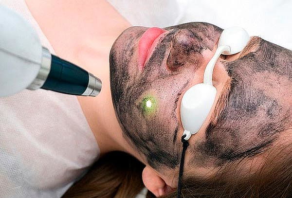 Hollywood Peel + Limpieza facial 1 Sesión
