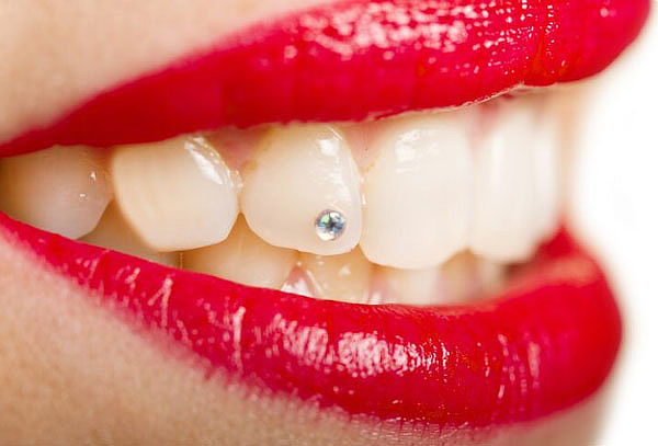 Piercing dental Simple en Grupo Bari 