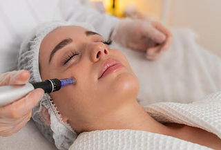 Rejuvenecimiento Facial con Exosomas y Microneedling
