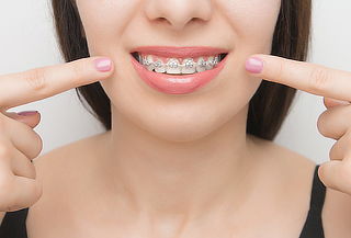 Retiro de Brackets Metálicos + Limpieza + Pulido de Cemento 