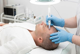 6 Sesiones de Mesoterapia Capilar a Domicilio
