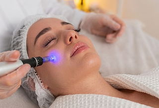 PDRN de Salmon + Micronideling + Limpieza facial +  AF