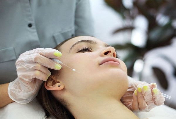 Rejuvenecimiento facial con Hilos Revitalizantes + PRP 