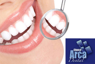 91% Limpieza Dental mas Blanqueamiento