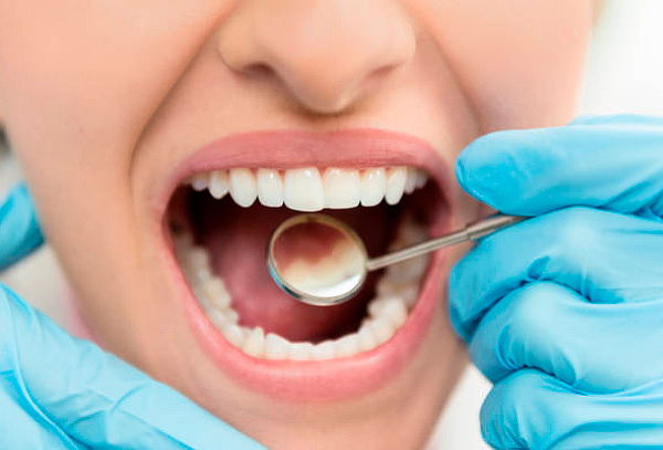 Limpieza Dental Completa + Desmanchado + Profilaxis