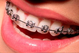 Brackets Inteligentes Mini Roth + Obsequio en Normandia