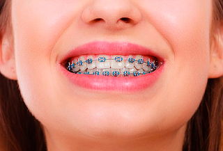 Brackets Inteligentes Mini Twin + Panorámica + Profilaxis