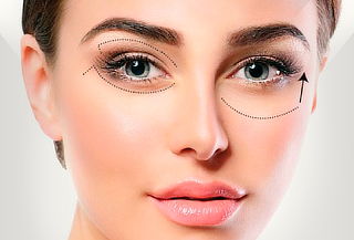 Blefaroplastia en Parpados NO Quirúrgica + Regalo