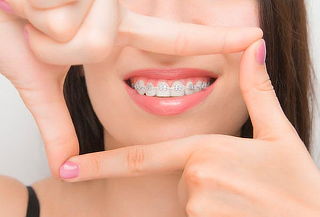 Montaje de Brackets + Valoración + Profilaxis en Fontibón