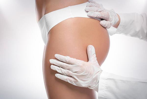 Reafirmación y Tonificación Glúteos con Vitamina C