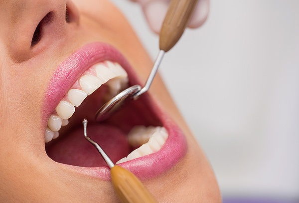 Corona Dental En Zirconio + Valoración 