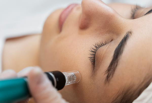 Rejuvenecimiento con Plasma y Limpieza Facial en El Polo