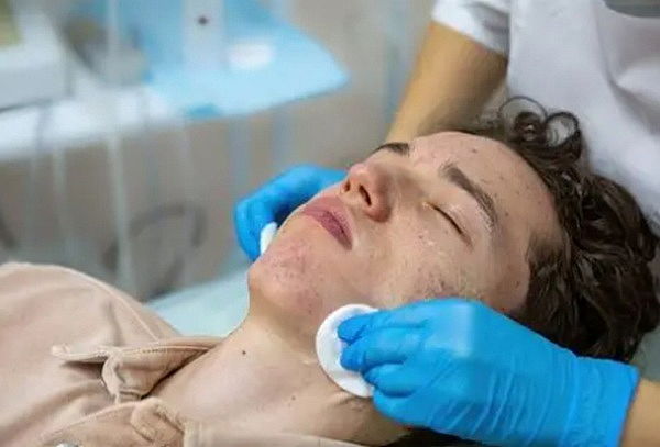 Protocolo Anti-Acné 6 Sesiones + Control Acné + Détox
