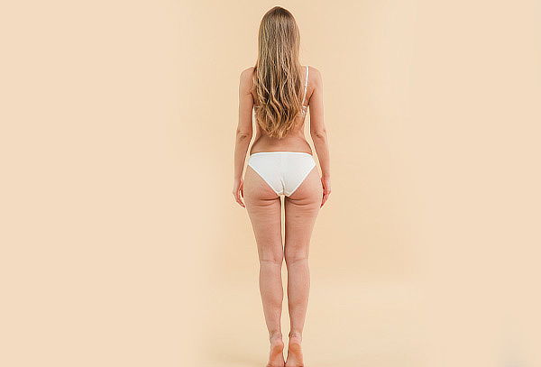 2x1 en 70 Sesiones de Eliminación de Celulitis 