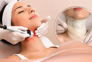 20 sesiones Eliminación Papada sin cirugia + Yesoterapia Red