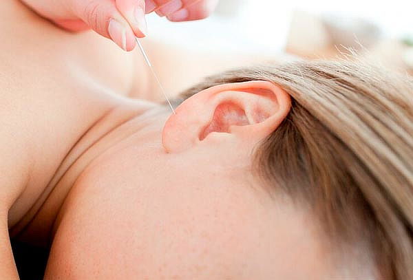 10 Citas de Auriculoterapia para Reducir Peso en Toberin  