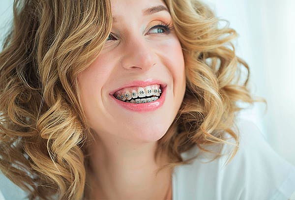 Brackets Técnica ROTH , Montaje Superior y Inferior 
