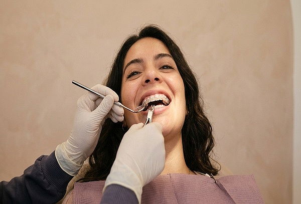 Retiro De Brackets + Profilaxis + Detartraje + Bono 50 %