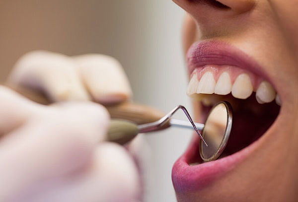 Limpieza Dental Completa + Blanqueamiento
