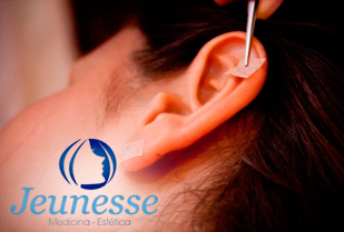 Reduce Tallas con Auriculoterapias y Mas