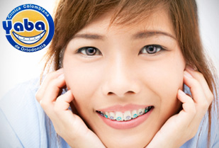 Montaje de Brackets Roth