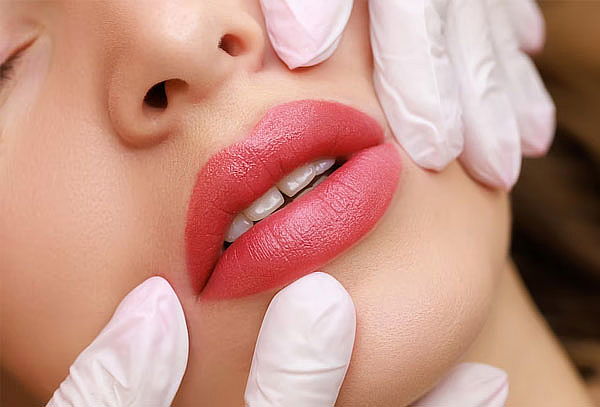 Lifting de labios con V-ST 