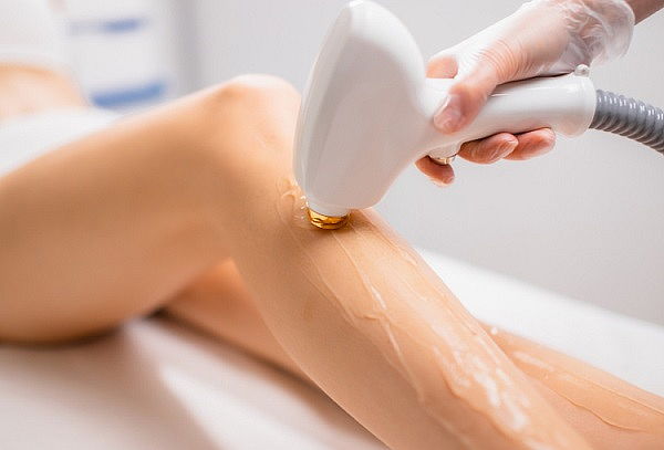 Depilación definitiva triodo, sin dolor (5 sesiones 4 zonas)