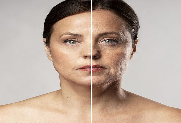 3 Sesiones de Lifting  con Radiofrecuencia + Drenaje facial