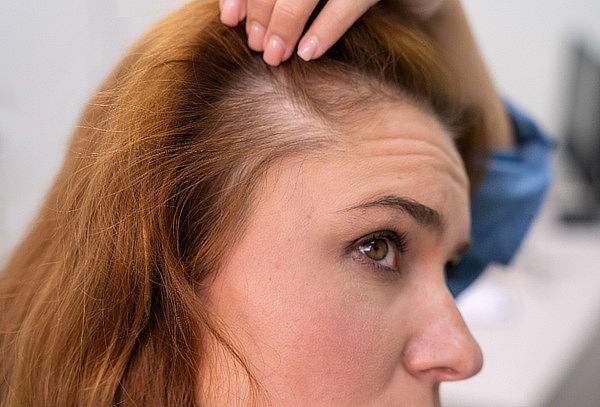 Fortalece tu cabello 5 sesiones de alta frecuencia capilar 