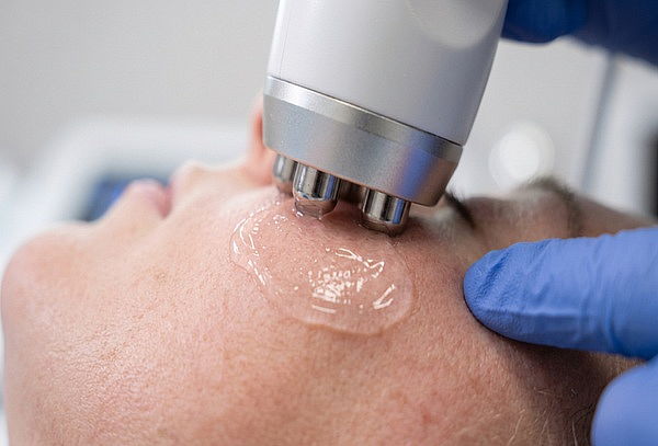 Radiofrecuencia Facial y Cuello para mejorar la Flacidez 