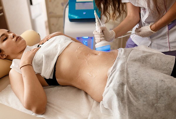 Cavitación para Redefinir y Moldear tu Abdomen
