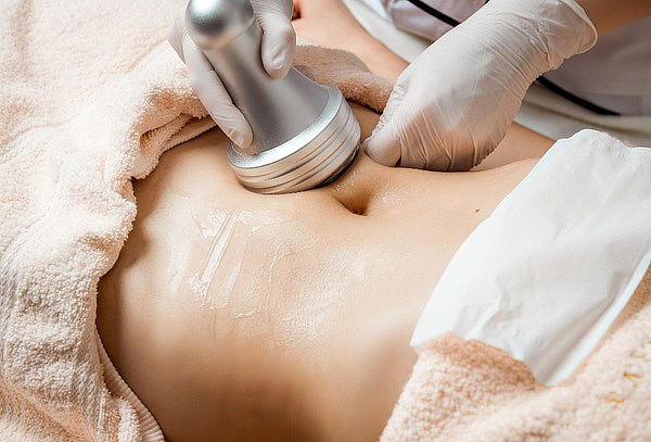 Cavitación para Redefinir y Moldear tu Abdomen