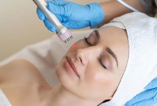 Radiofrecuencia Facial Profunda: Detox y Rejuvenecimiento