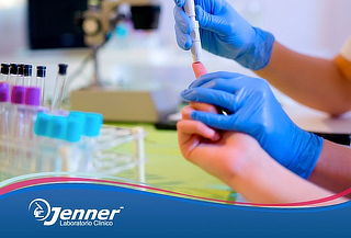 Análisis Clínicos en Jenner® 30 Sucursales