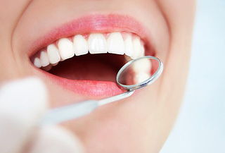 Blanqueamiento dental láser ¡Sonrisa reluciente!