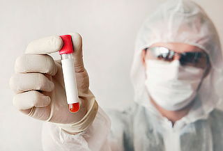 Examen Preventivo HIV 1.2 + HIV P24 en RyR Laboratorios 